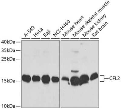Western Blot: Cofilin 2 Antibody [NBP2-92683] - Western blot analysis of extracts of various cell lines, using Cofilin 2 antibody (NBP2-92683) at 1:1000 dilution. Secondary antibody: HRP Goat Anti-Rabbit IgG (H+L) at 1:10000 dilution. Lysates/proteins: 25ug per lane. Blocking buffer: 3% nonfat dry milk in TBST. Detection: ECL Basic Kit. Exposure time: 30s.